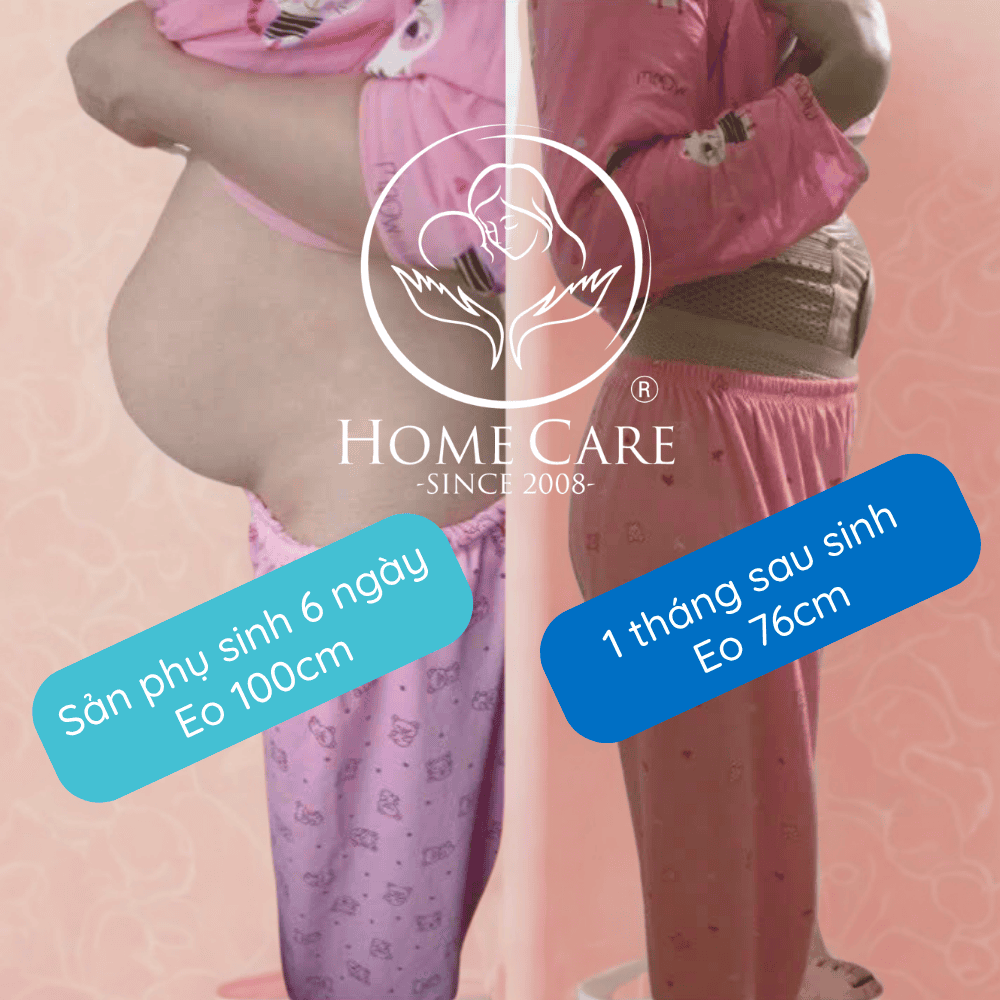 dich-vu-giam-mo-bung-giam-eo-sau-sinh-tai-nha-home-care1