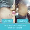dich-vu-giam-mo-bung-giam-eo-sau-sinh-tai-nha-home-care4