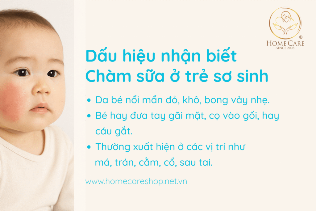 Dấu hiệu nhận biết Chàm sữa ở trẻ sơ sinh