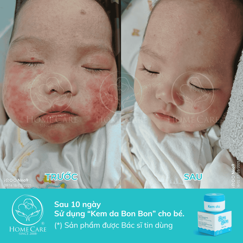 FEEDBACK-KEM-DA-BONBON-2025-a2