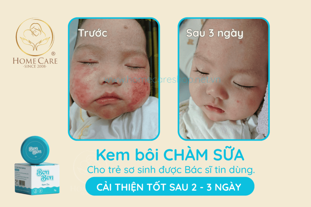Kem -boi cham-sua-cho-tre-so-sinh (1)