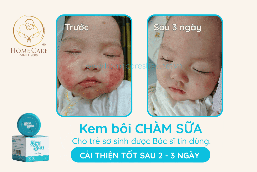 Kem -boi cham-sua-cho-tre-so-sinh