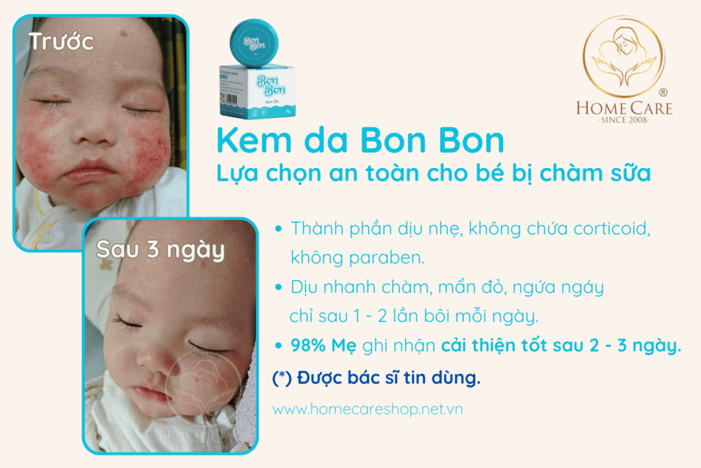 kem-boi-cham-sua-an-toan-cho-be-so-sinh-bonbon