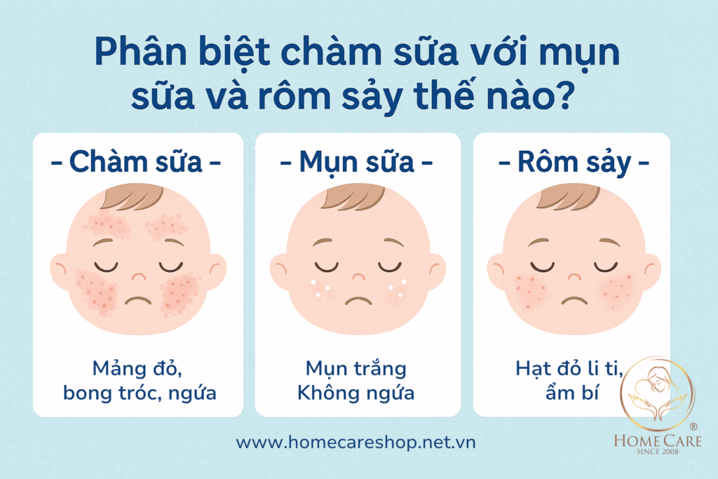 phan-biet-cham-sua-mun-sua-rom-say-o-tre-so-sinh
