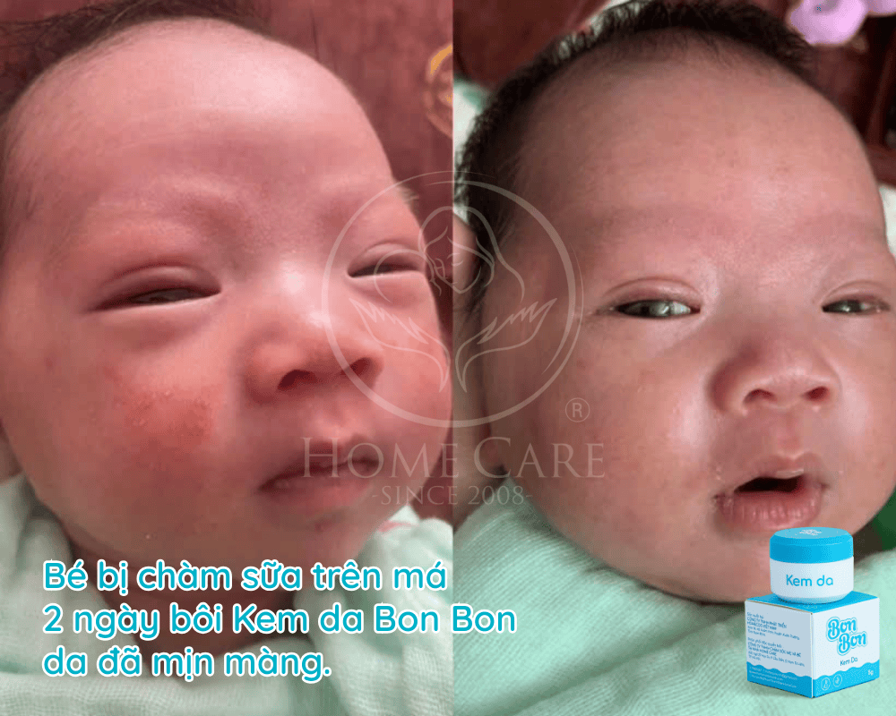 be-bi-cham-sua-o-mat-1