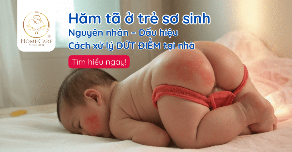 HĂM TÃ: Nguyên nhân, dấu hiệu và cách xử lý tại nhà mẹ cần biết