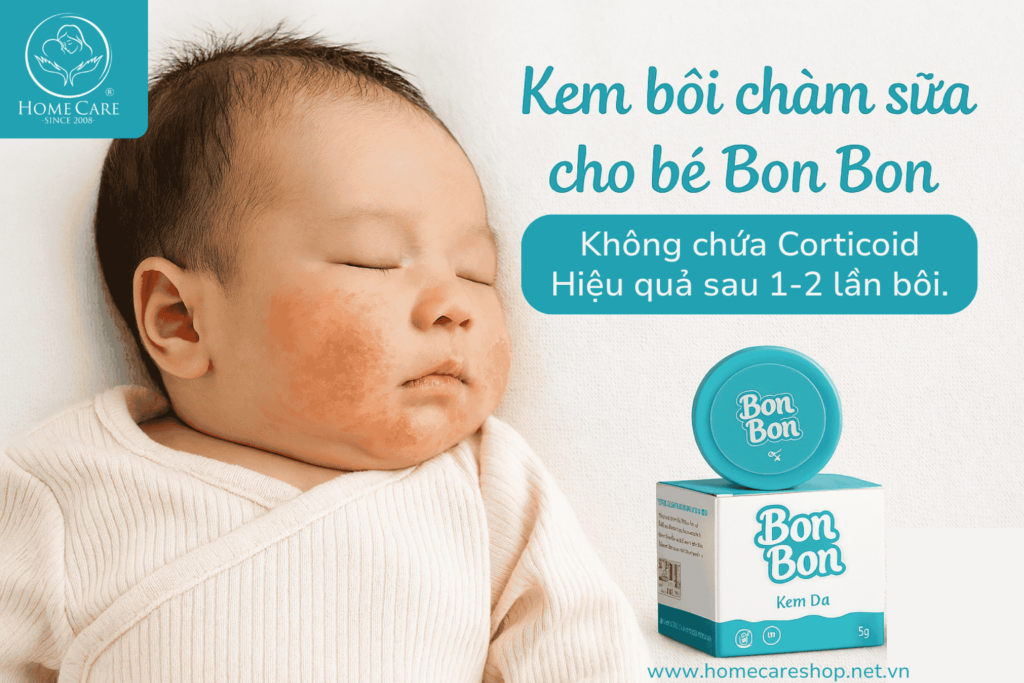 kem-boi-cham-sua-cho-be-bonbon