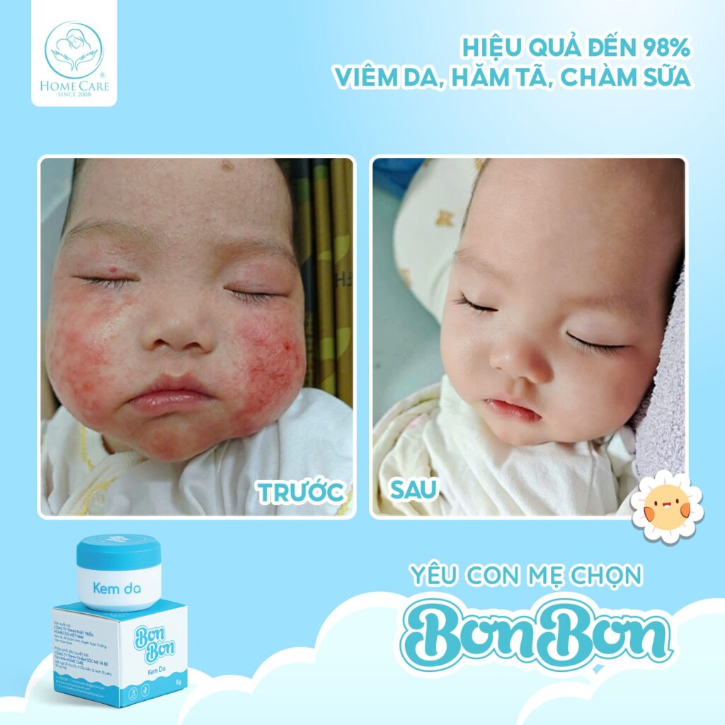 Chuẩn Bị Đồ Đi Sinh Mẹ Đừng Quên Kem Chăm Da Cho Bé (2)-min