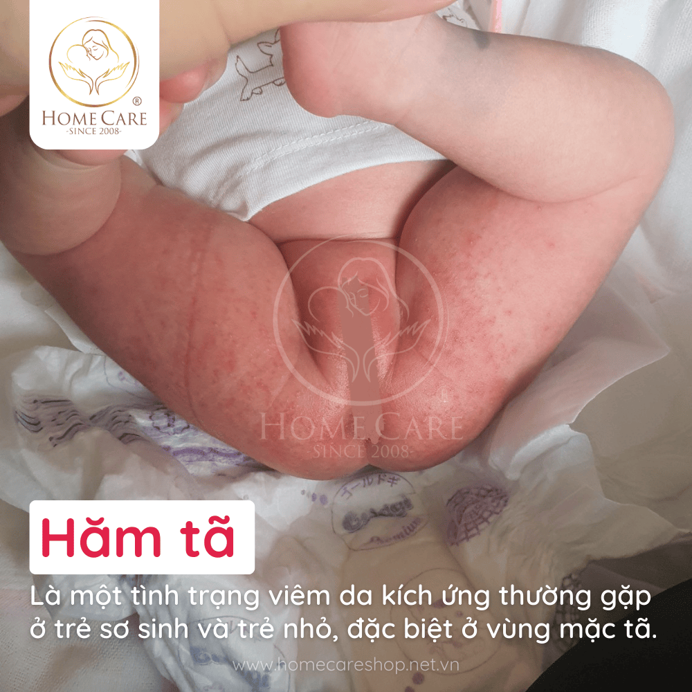 ham-ta-o-tre-so-sinh