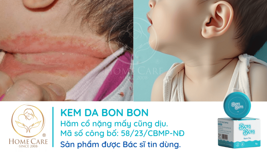kem-boi-ham-co-cho-tre-so-sinh