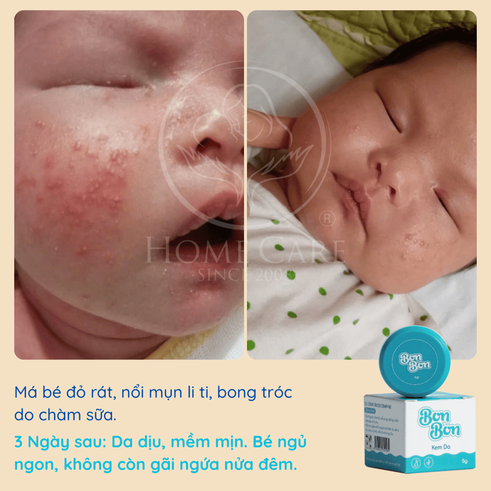 review-feedback-hieu-qua-kem-da-bon-bon-home-care
