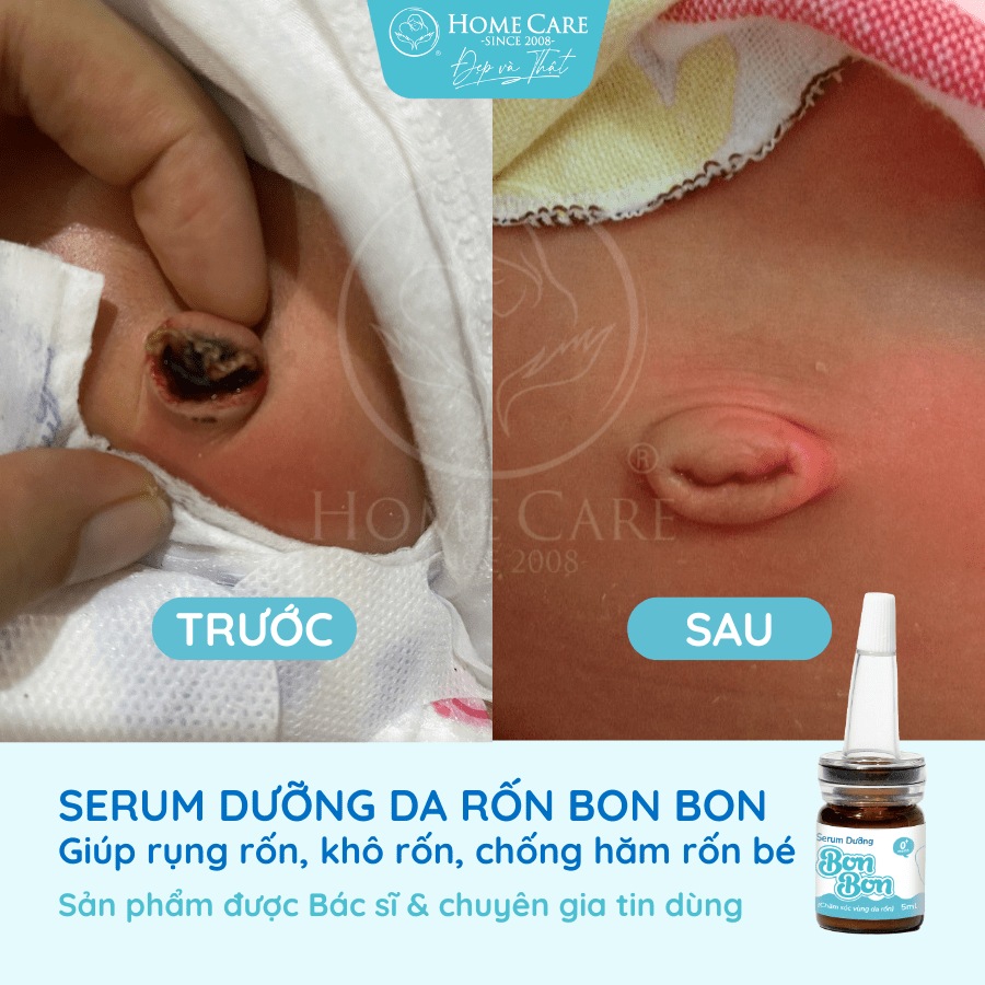 serum-duong-ron-cho-be-serum-cham-soc-ron-ve-sinh-ron-cho-be-bonbon-cua-homecare-a2-min