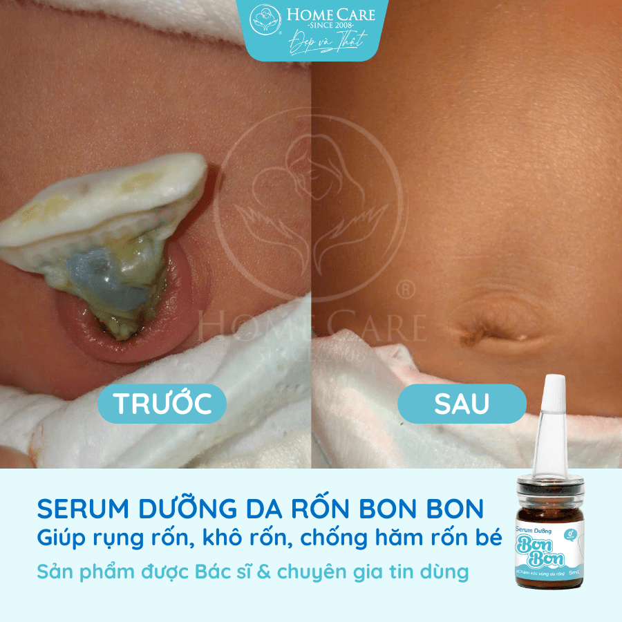 serum-duong-ron-cho-be-serum-cham-soc-ron-ve-sinh-ron-cho-be-bonbon-cua-homecare-a3-min