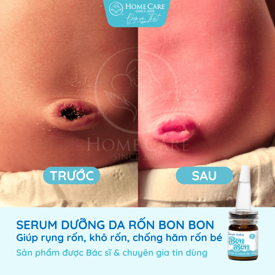 serum-duong-ron-cho-be-serum-cham-soc-ron-ve-sinh-ron-cho-be-bonbon-cua-homecare-a6-min
