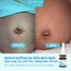 serum-duong-ron-cho-be-serum-cham-soc-ron-ve-sinh-ron-cho-be-bonbon-cua-homecare-a6-min