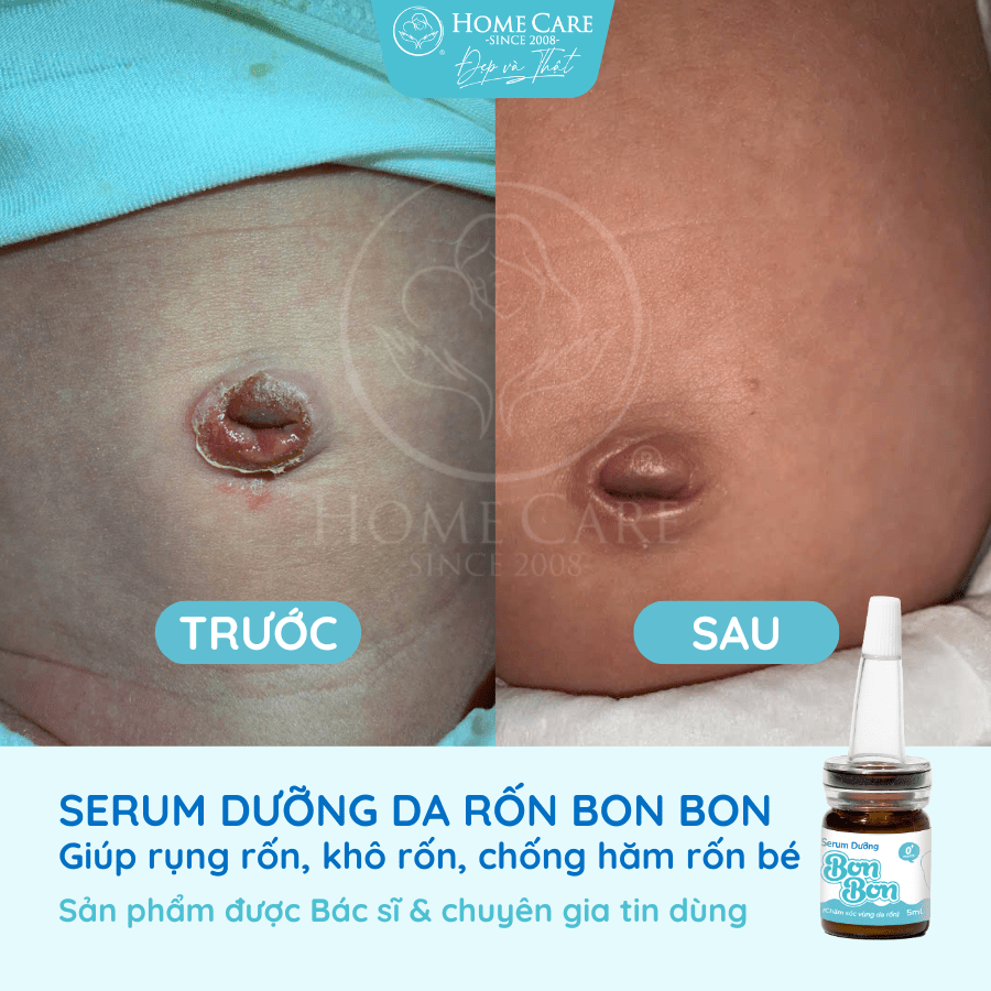 serum-duong-ron-cho-be-serum-cham-soc-ron-ve-sinh-ron-cho-be-bonbon-cua-homecare-a6-min