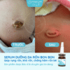 serum-duong-ron-cho-be-serum-cham-soc-ron-ve-sinh-ron-cho-be-bonbon-cua-homecare-a7-min